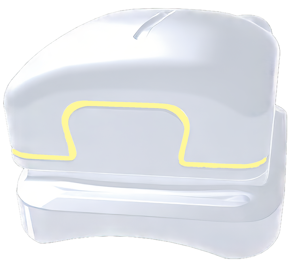 CLIX Ceramic SL kit