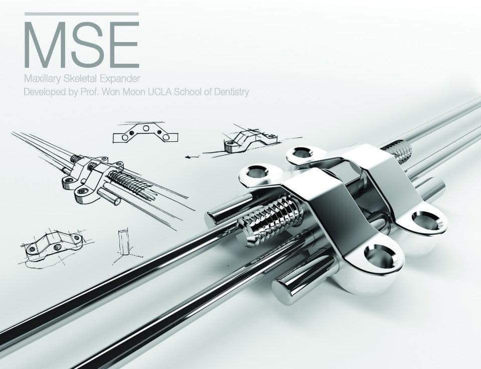 MSE II Skeletal Expander