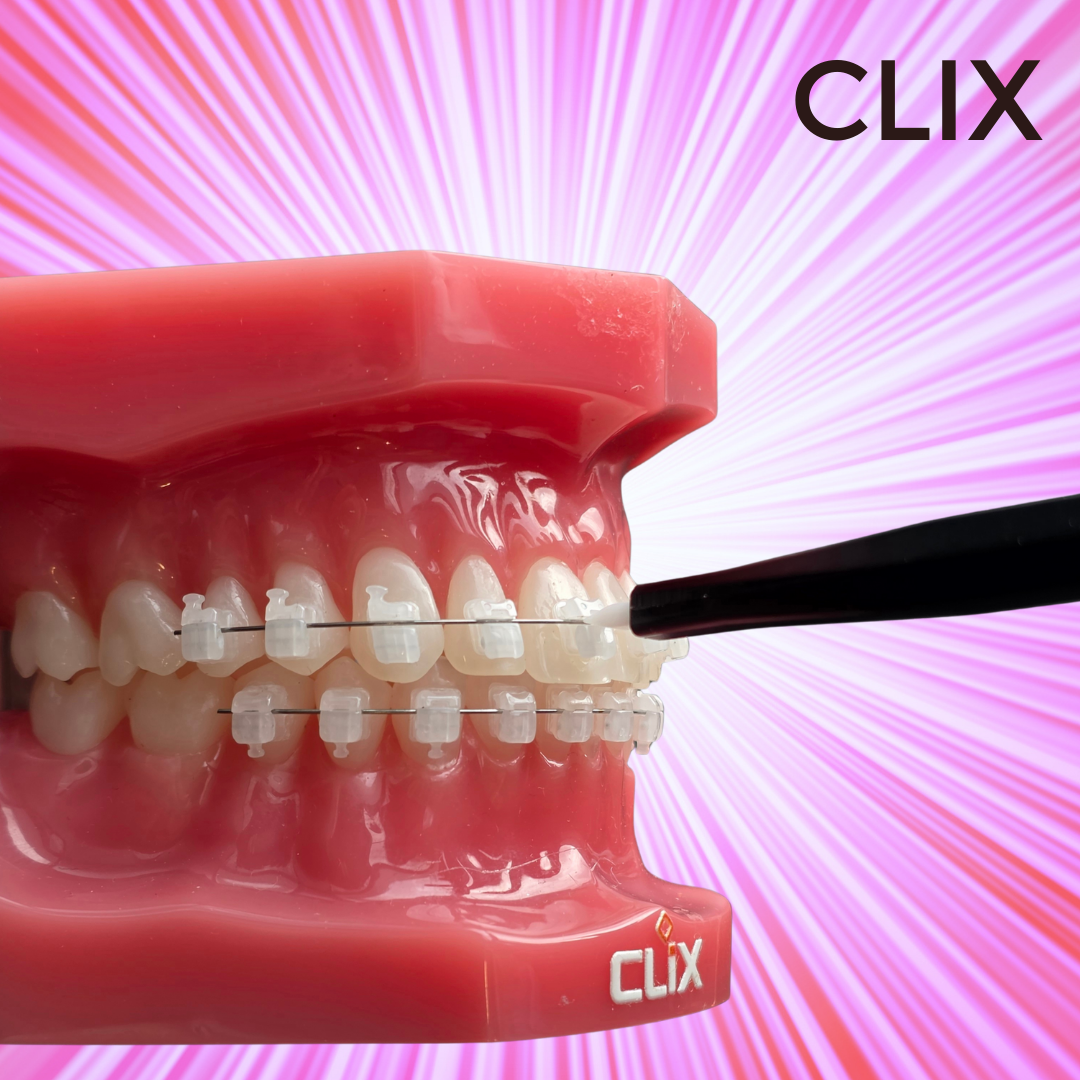 CLIX Ceramic SL kit