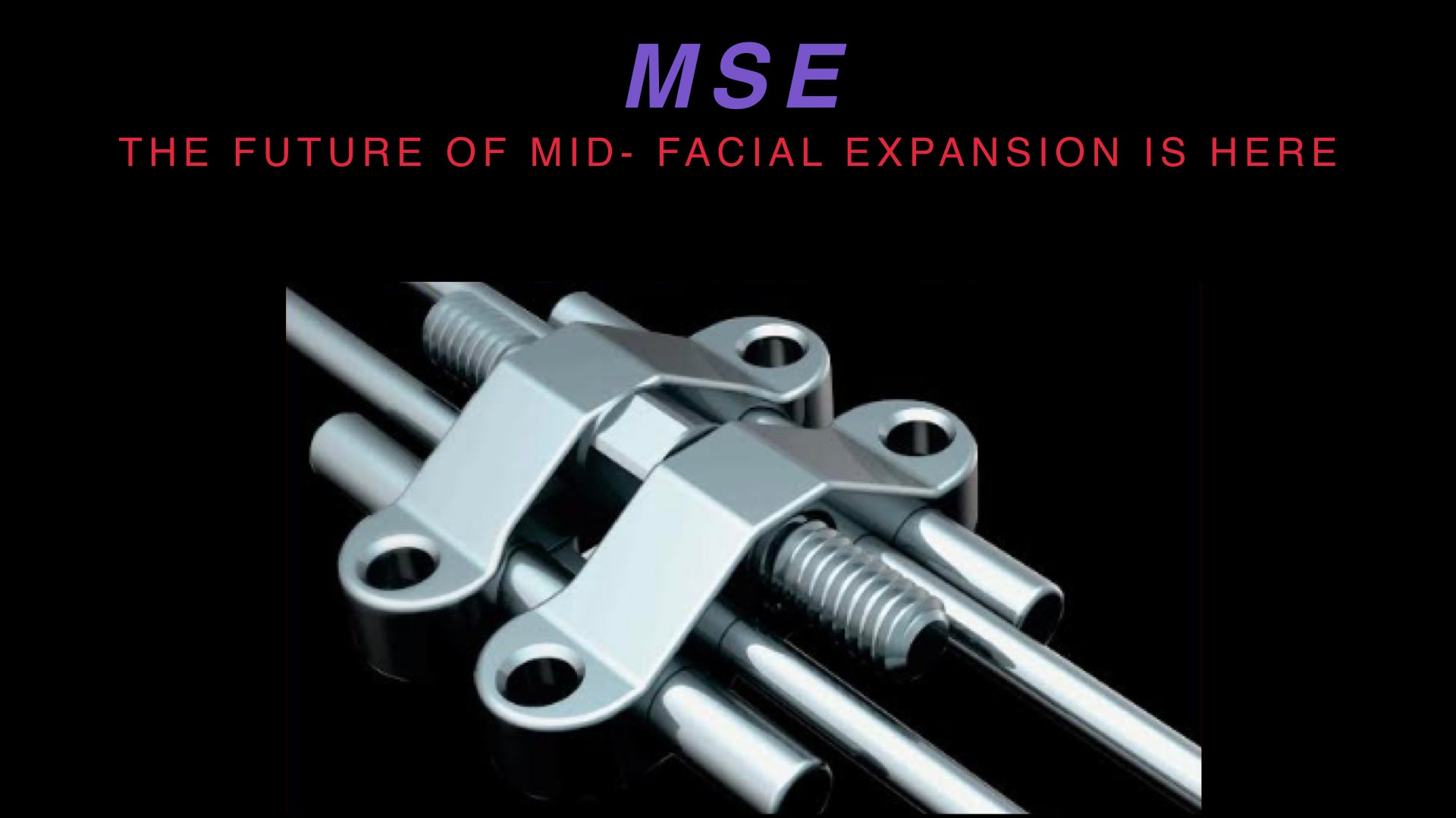 MSE II Skeletal Expander