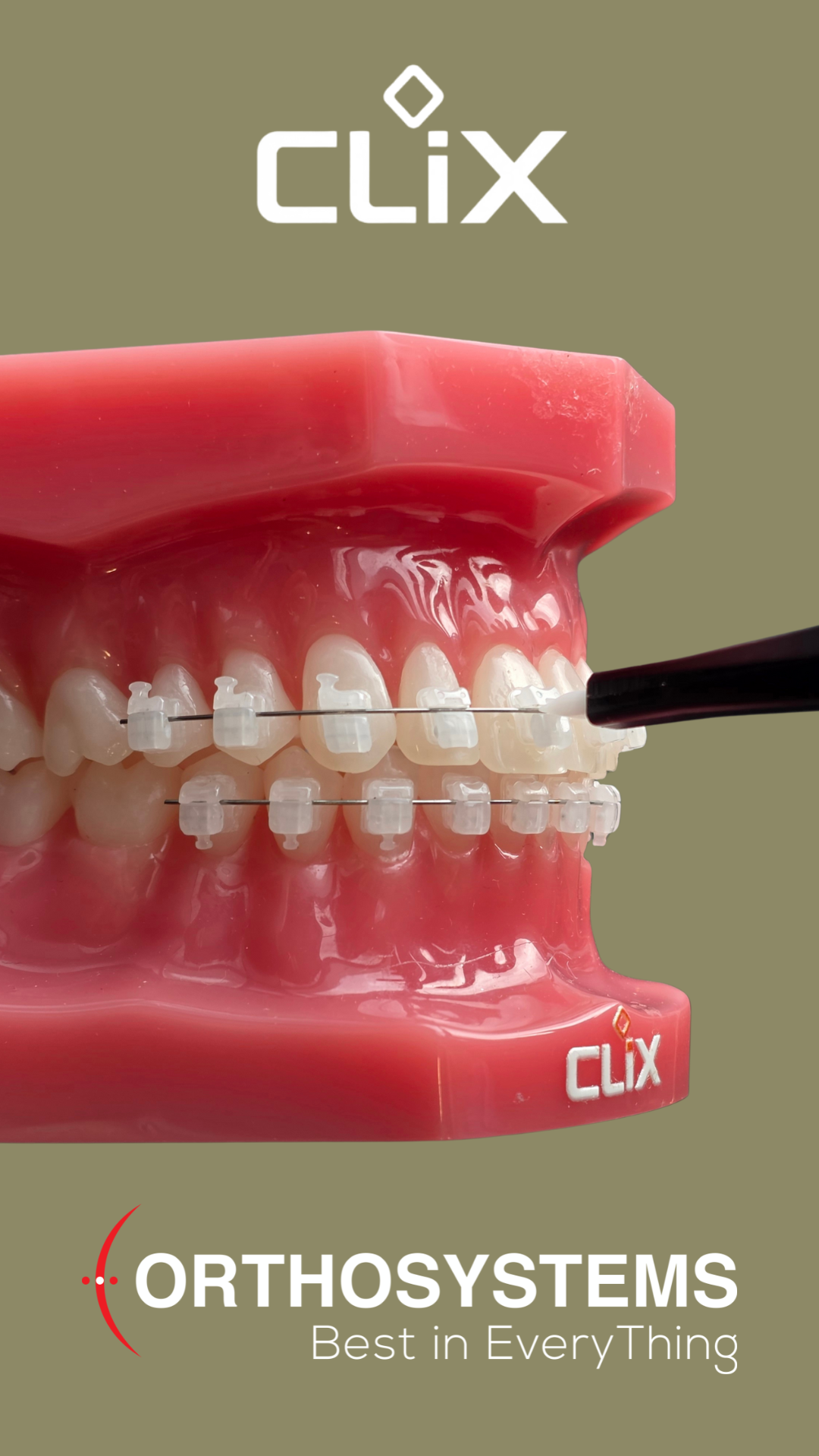 CLIX Ceramic SL kit